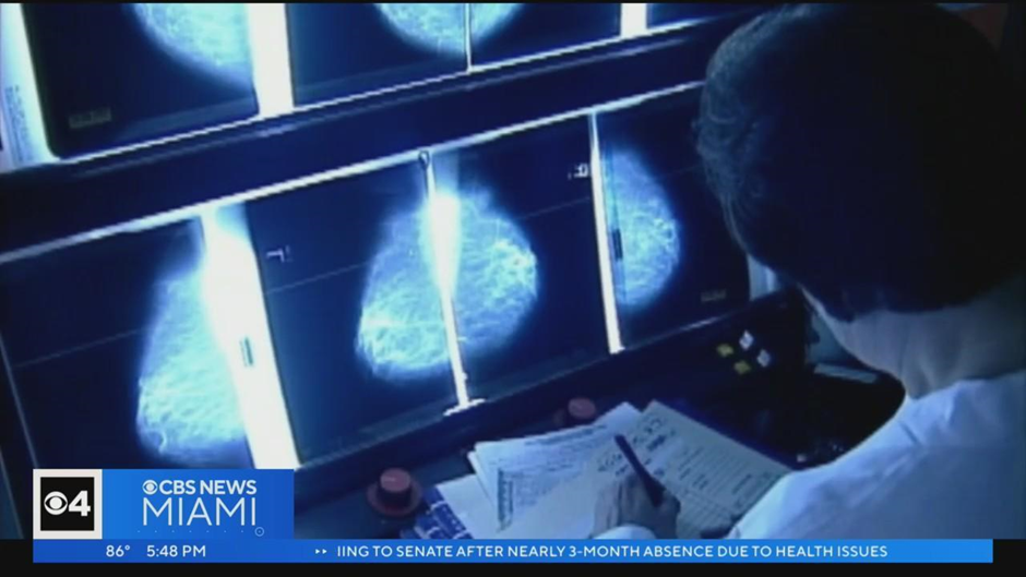 Redefining Breast Cancer Screening: Starting at 40 Instead of 50