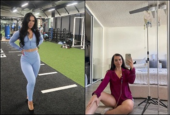 Fitness Influencer Beatriz’s Nightmare: Mycobacterium Abscessus Infection After Fat-Burning Injections